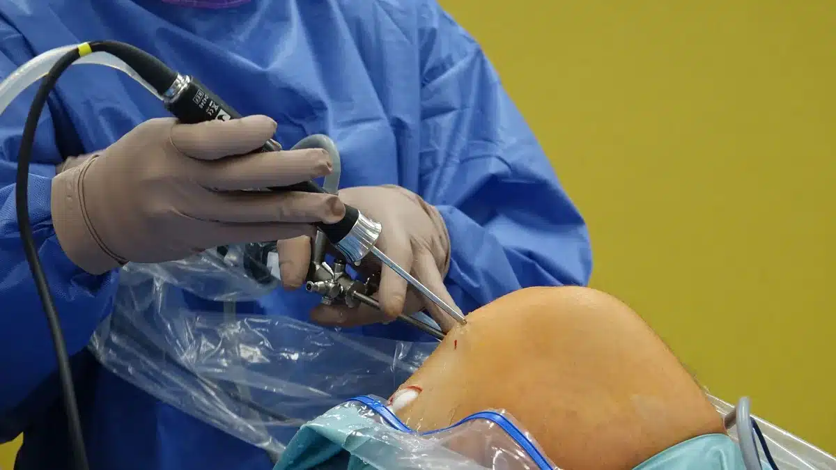 Intervento chirurgico al ginocchio in sala operatoria con strumenti medici